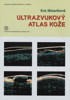 Ultrazvukový atlas kože - 