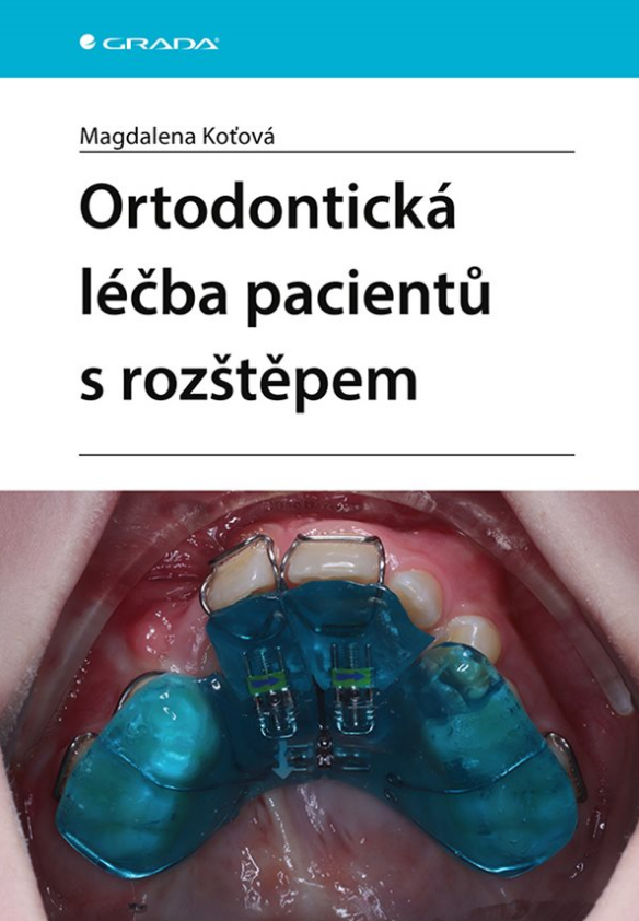 Ortodontická léčba pacientů s rozštěpem - 