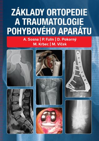 Základy ortopedie a traumatologie pohybového aparátu - 