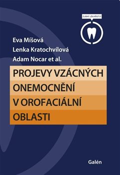 Projevy vzácných onemocnění v orofaciální oblasti - 