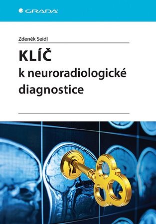 Klíč k neuroradiologické diagnostice - 