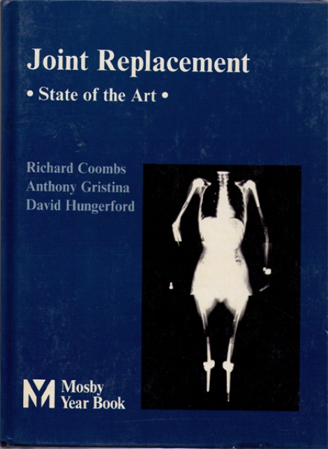 Joint Replacement State of the Art - 