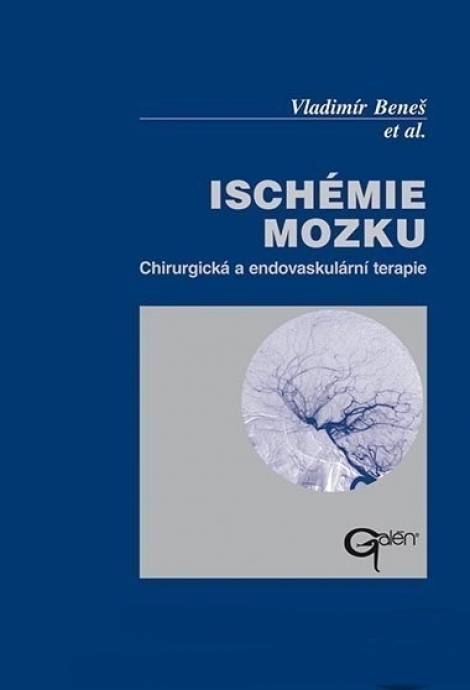 Ischémie mozku - Chirurgická a endovaskulární terapie