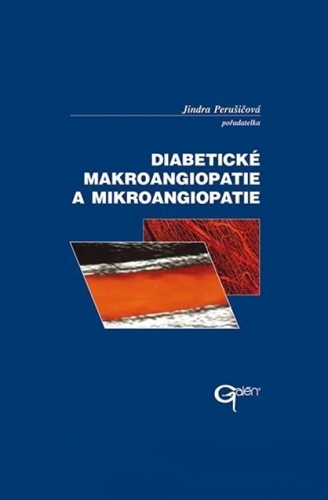 Diabetické makroangiopatie a mikroangiopatie - Jindra Perušičová