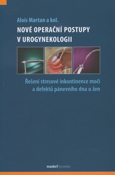 Nové operační postupy v urogynekologii - Řešení stresové inkontinence moči a defektů pánevního dna u žen