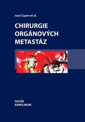 Chirurgie orgánových metastáz - 