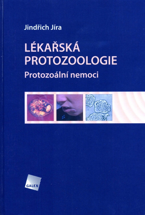 Lékařská protozoologie - Protozoální nemoci