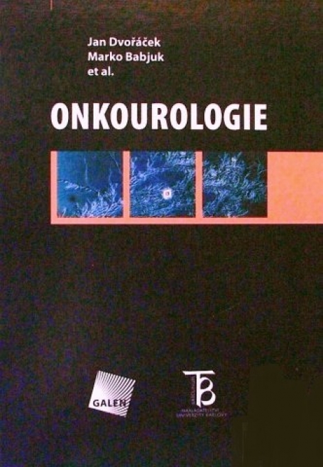 Onkourologie - 