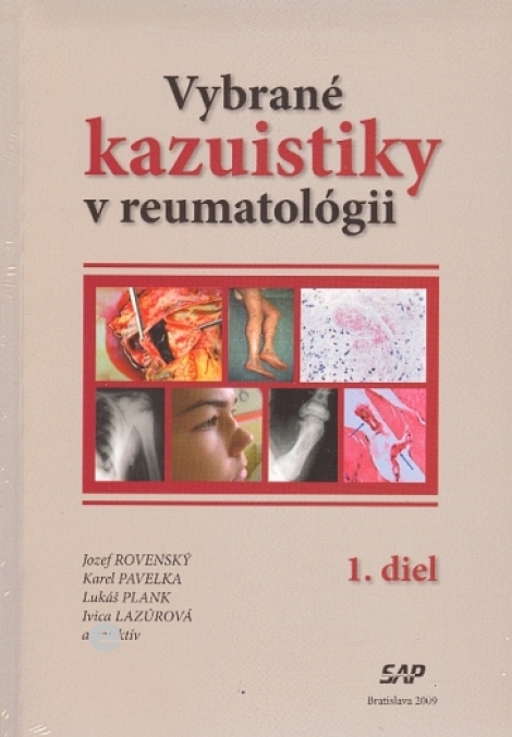 Vybrané kazuistiky v reumatológii (1+2 diel) - Jozef Rovenský, Karel Pavelka, Lukáš Plank, Ivica Lazúrová