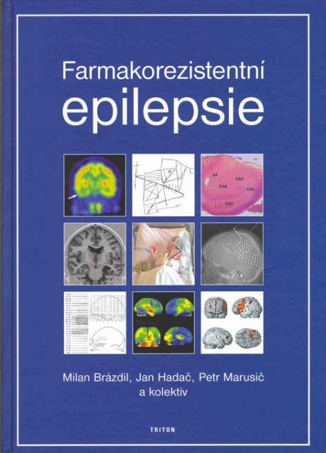 Farmakorezistentní epilepsie - 