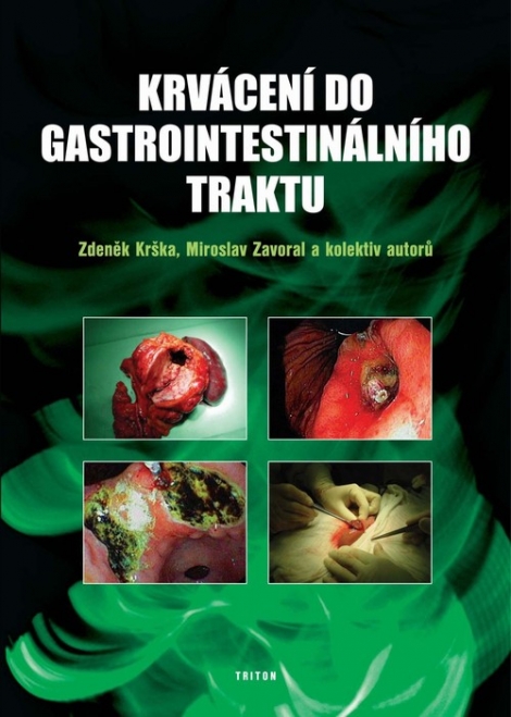 Krvácení do gastrointestinálního traktu - 