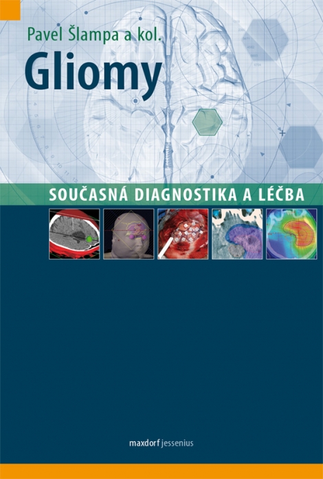 Gliomy – současná diagnostika a léčba - 