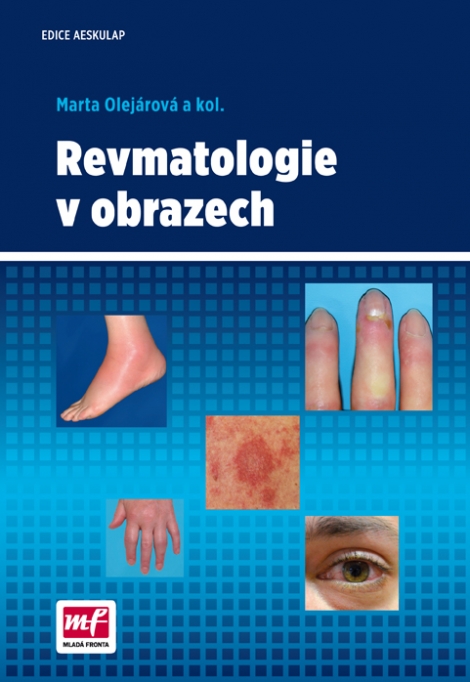 Revmatologie v obrazech - 
