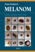 Melanom - Klasifikace, diagnostika, terapie, prevence