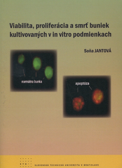 Viabilita, proliferácia a smrť buniek kultivovaných v in vitro podmienkach - 