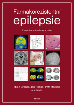 Farmakorezistentni epilepsie - 2. doplněné a aktualizované vydání