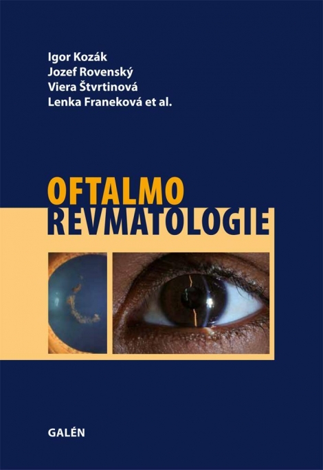 Oftalmorevmatologie - 
